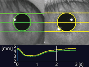 Measure Pupil Size and Reactivity with the NPi®-300 Pupillometer